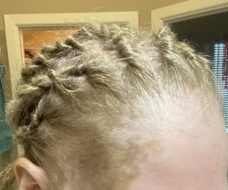 Forever Young Skin Care