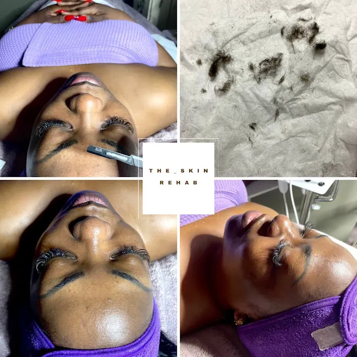 The skin rehab Picture 5