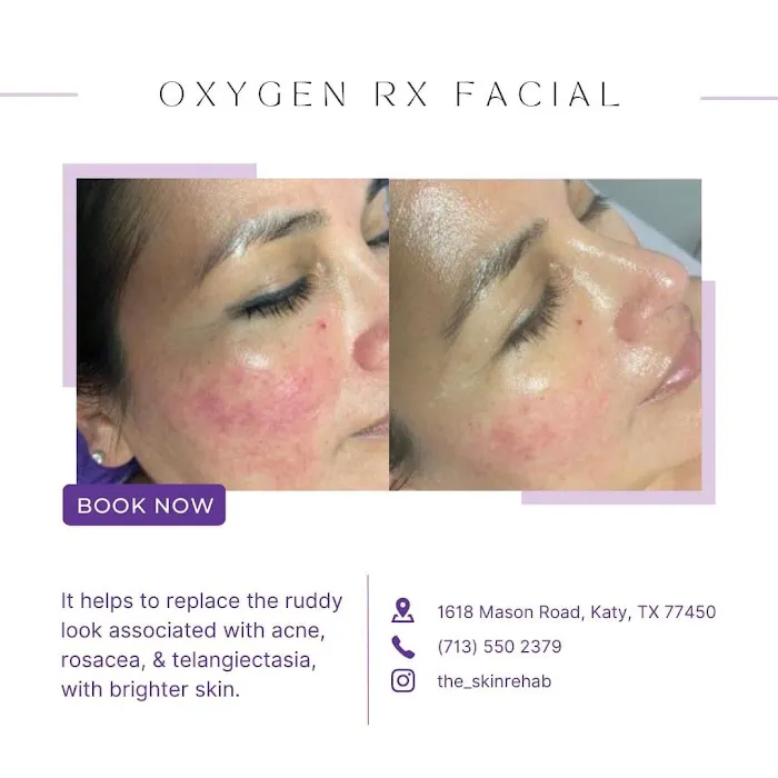 The skin rehab Picture 6