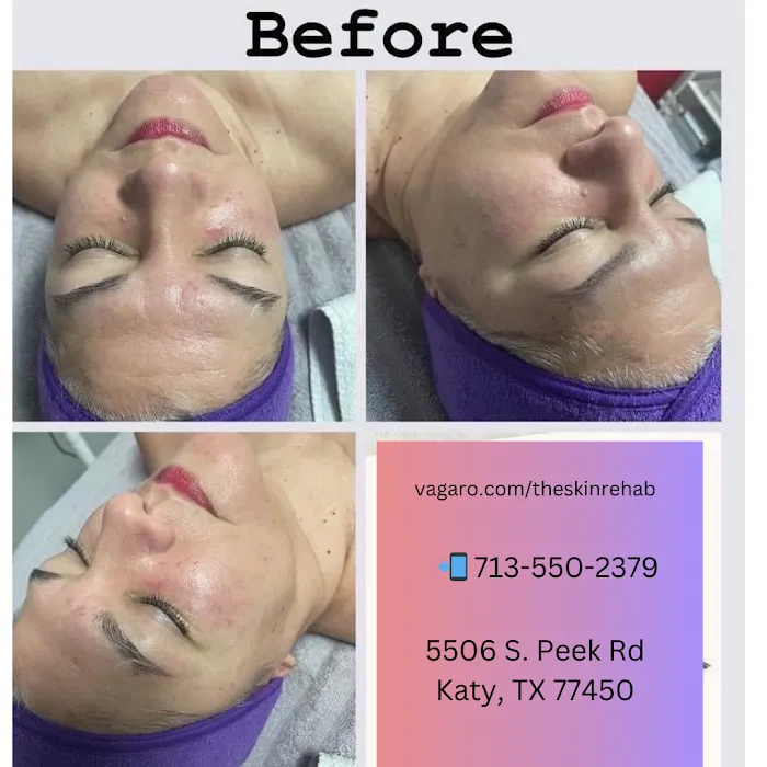 The skin rehab Picture 10