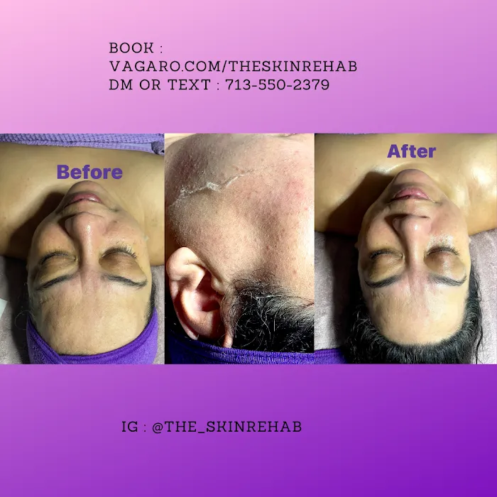 The skin rehab Picture 9