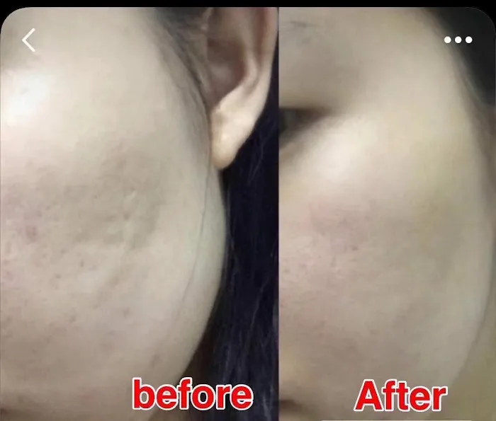 Baby face skin care Picture 1