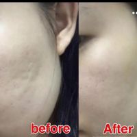 Baby face skin care ico