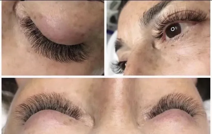 Baby face skin care Picture 10