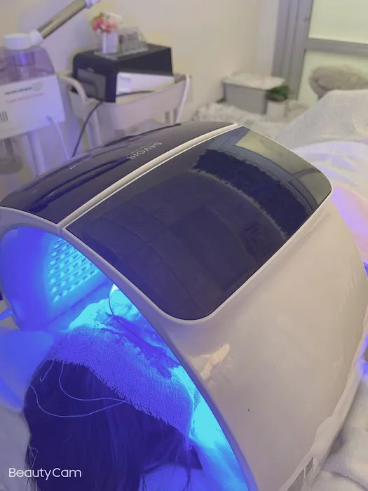 Baby face skin care Picture 6