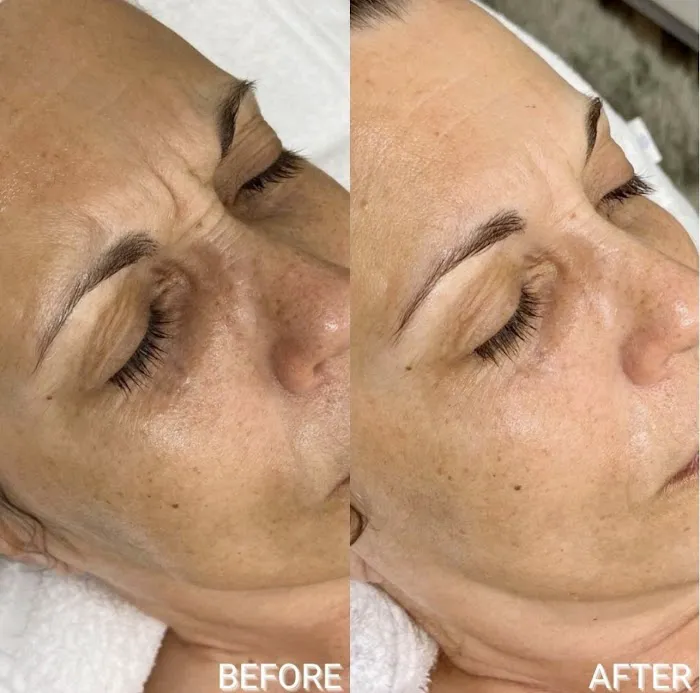 Baby face skin care Picture 8