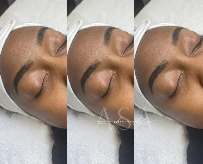 Atomic Skin Picture 9