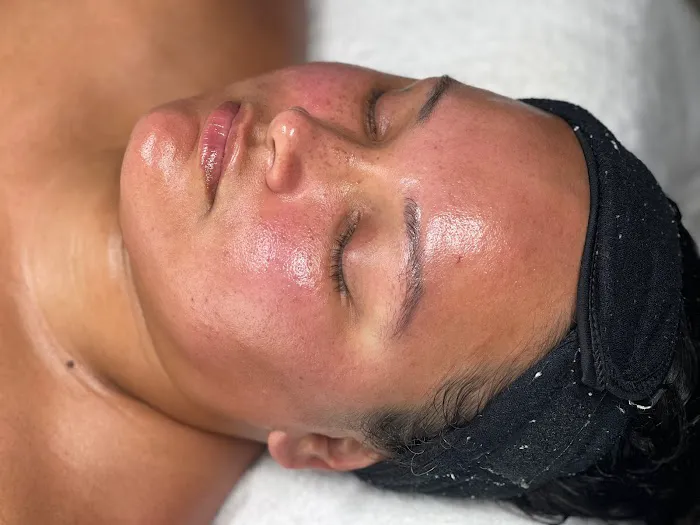 Atomic Skin Picture 10