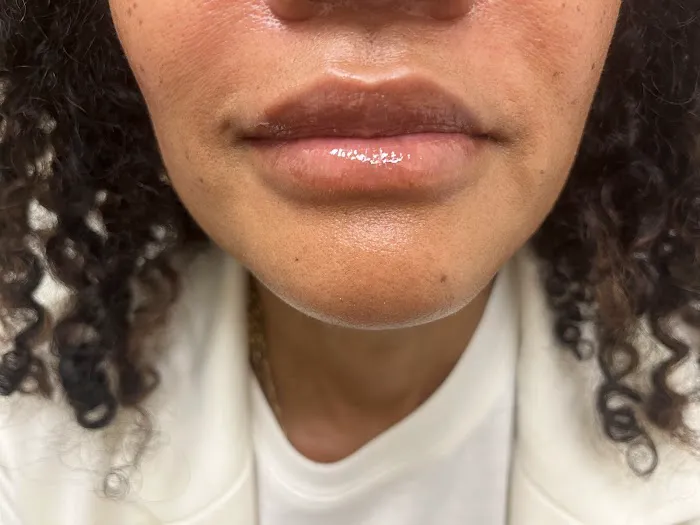 Chehr Laser & Medical Spa Picture 4