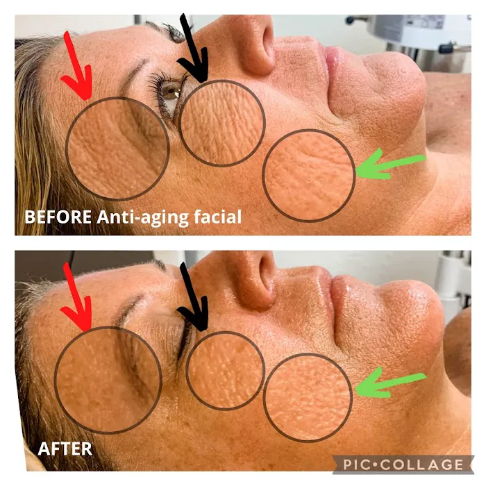 Trish My Esthetician Picture 2