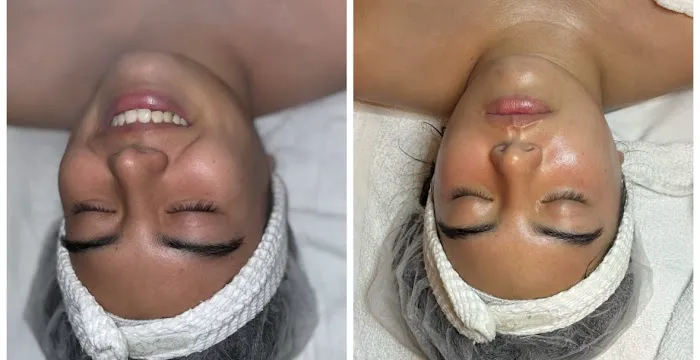 The Charismatic Skin Picture 2