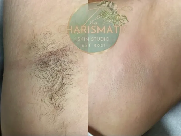 The Charismatic Skin Picture 1