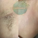 The Charismatic Skin