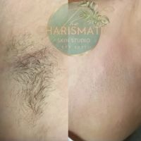 The Charismatic Skin ico