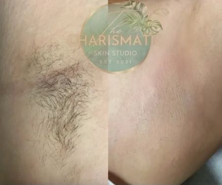 The Charismatic Skin