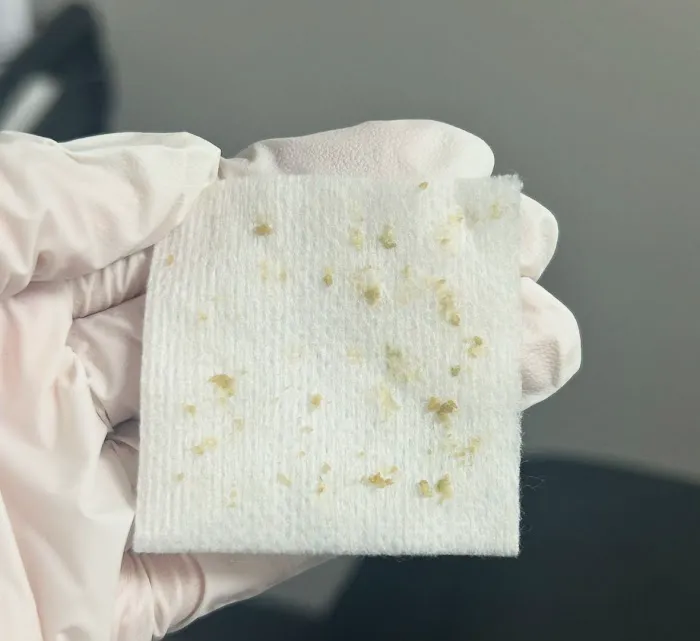 The Charismatic Skin Picture 4