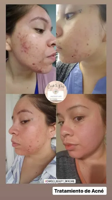 Carol's Beauty & Skincare Picture 1