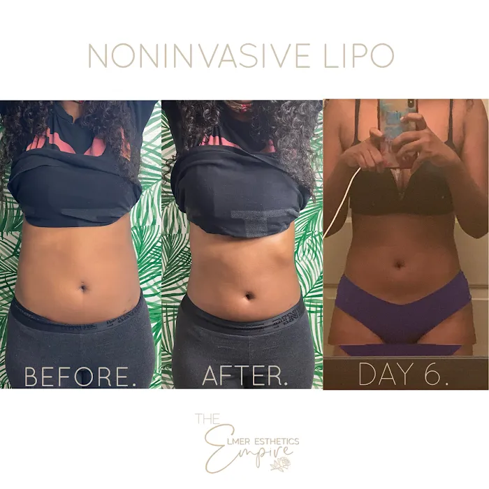 The Elmer Esthetics Empire Picture 10