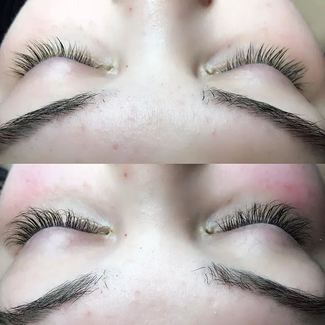 SuperNova Skin Picture 4