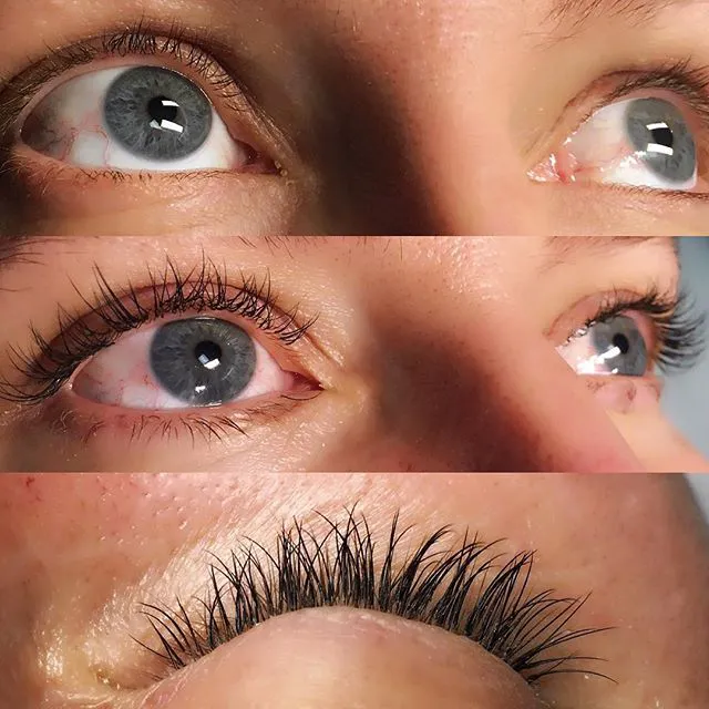 SuperNova Skin Picture 2