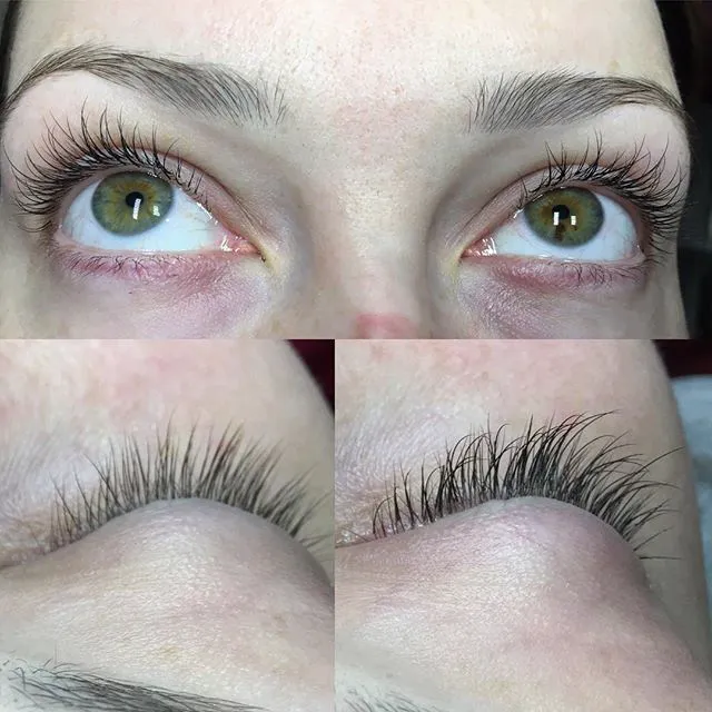 SuperNova Skin Picture 9