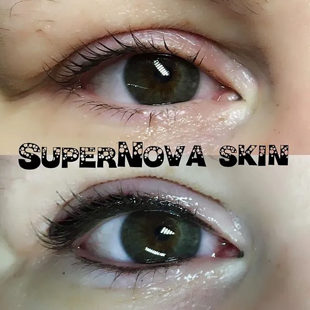 SuperNova Skin Picture 7
