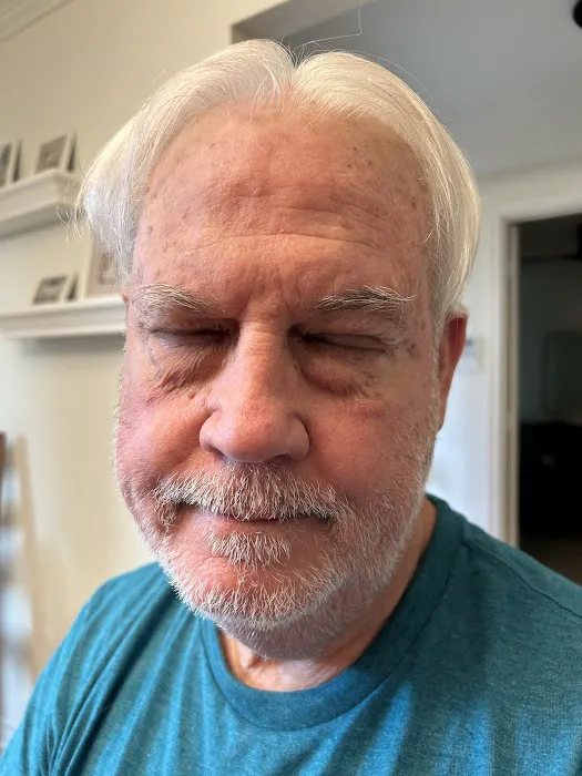 Texas Surgical Dermatology PA Picture 8