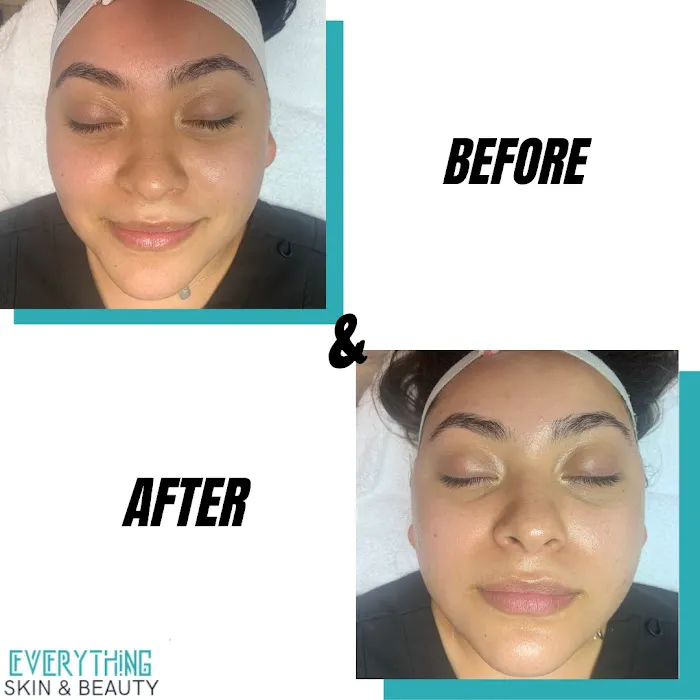 Everything Skin and Beauty Picture 1