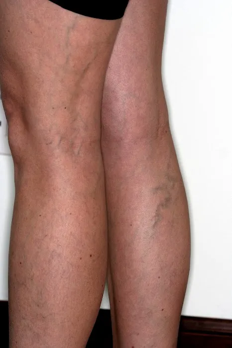 Reger Vein & Skin Specialists Picture 2