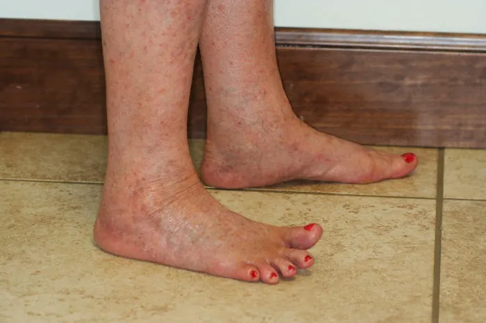 Reger Vein & Skin Specialists Picture 4