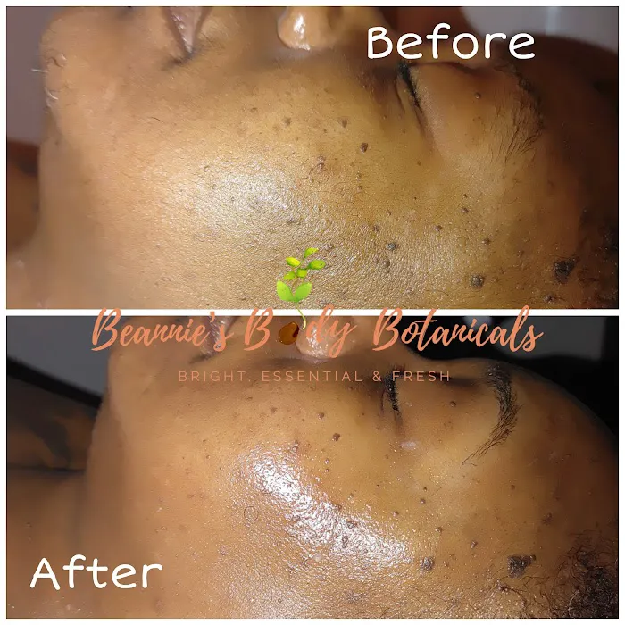 Beannie's Body Therapy & Botanicals Picture 10