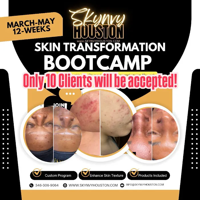 Skynvy Houston Picture 7