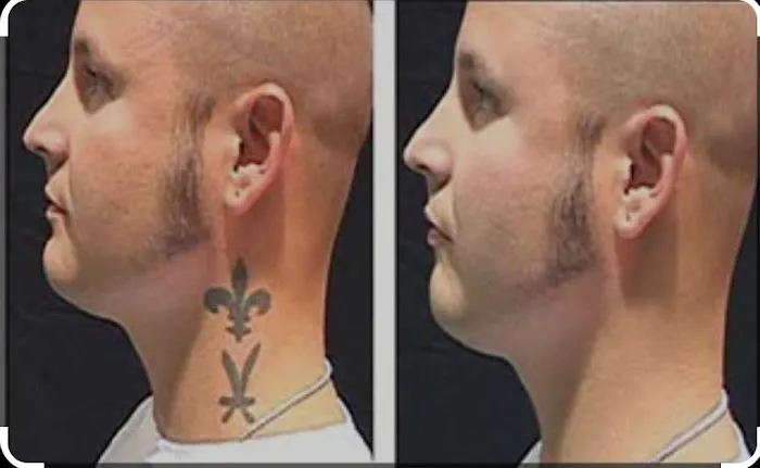 American Laser Group Picture 6