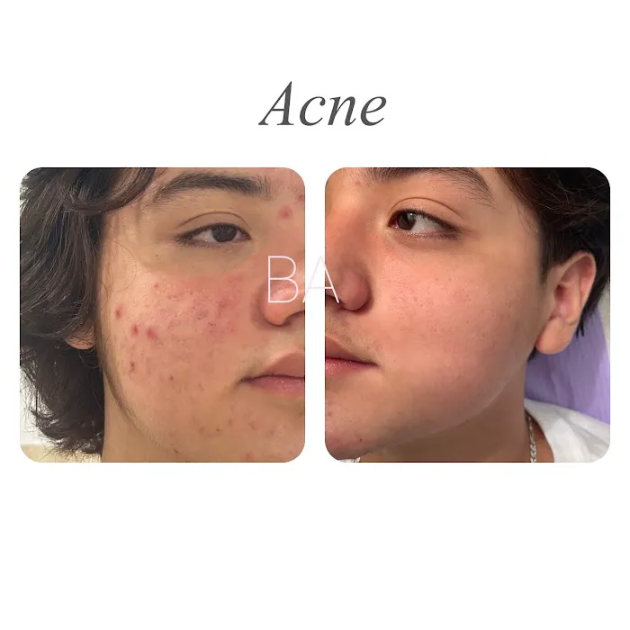 BAesthetics Picture 3