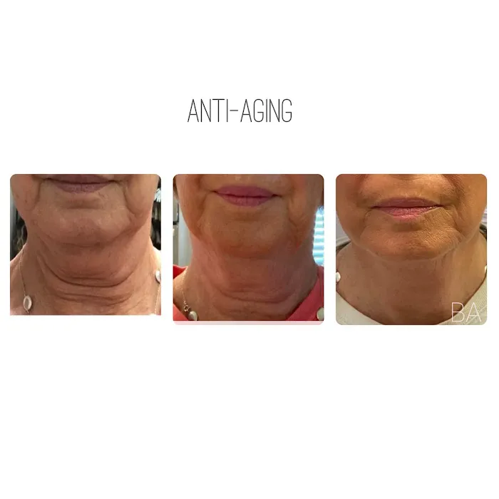 BAesthetics Picture 6