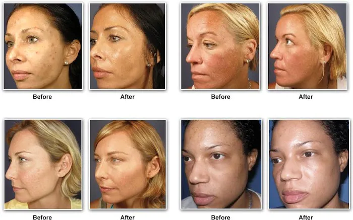 BAesthetics Picture 1