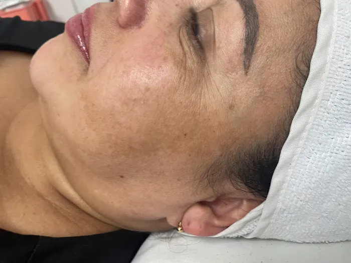 Dermad Skincare & Wellness Picture 6