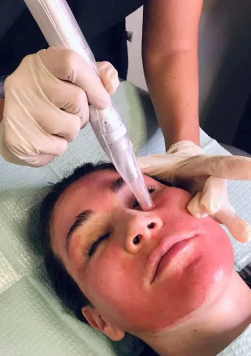 Dermad Skincare & Wellness Picture 5