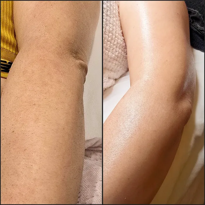 Aeri Aesthetics Picture 7