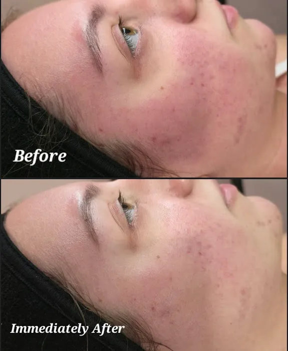 Aeri Aesthetics Picture 6