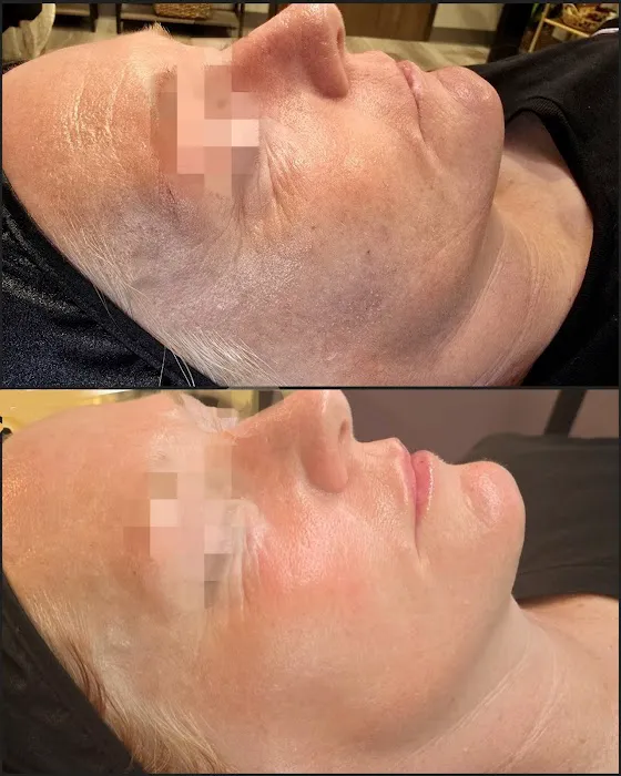 Aeri Aesthetics Picture 3