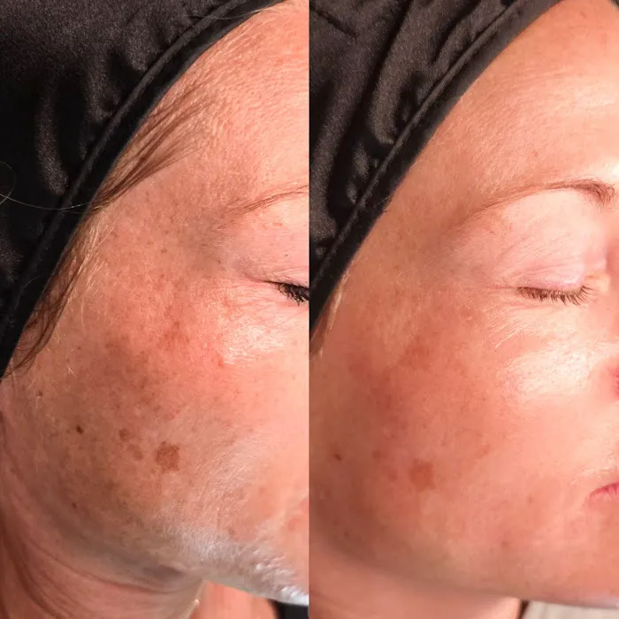 Aeri Aesthetics Picture 4