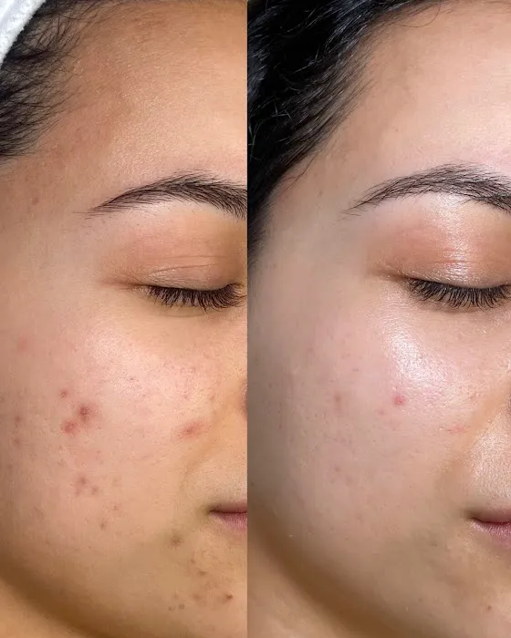 Skin Chateau Beauty Studio Picture 9