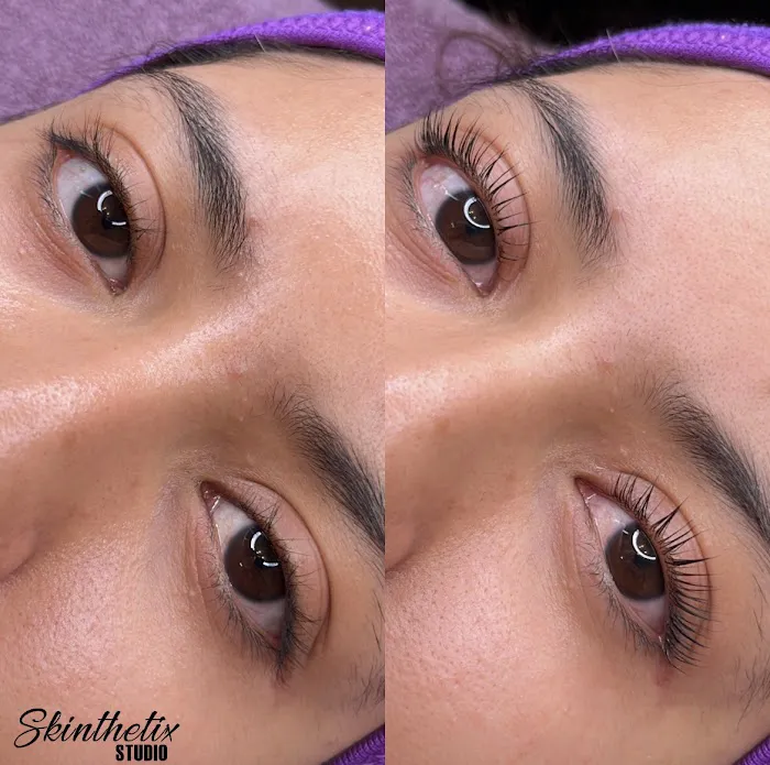 Skinthetix Studio LLC Picture 7