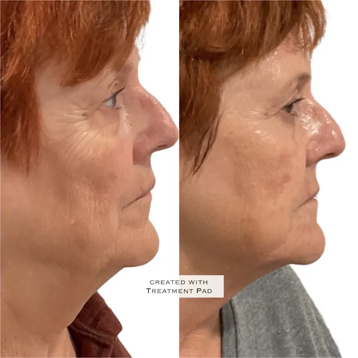 JaLaine Aesthetics & Wellness Picture 6