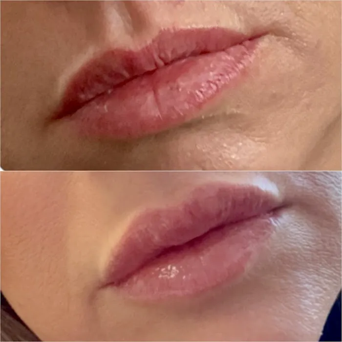 JaLaine Aesthetics & Wellness Picture 3