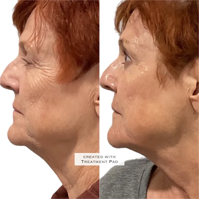 JaLaine Aesthetics & Wellness Picture 4