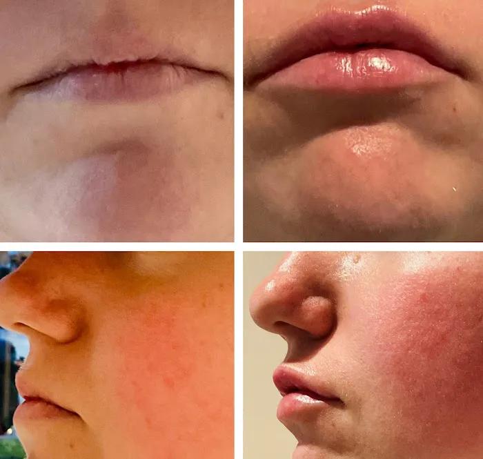 JaLaine Aesthetics & Wellness Picture 9