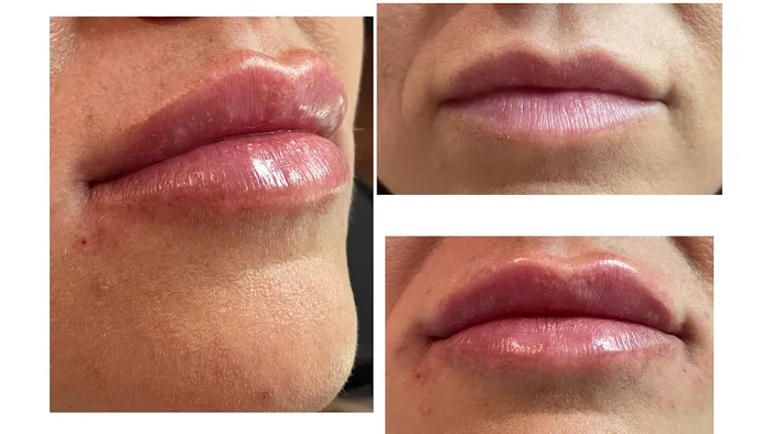 Shelbi Aesthetics and Wellness Picture 5