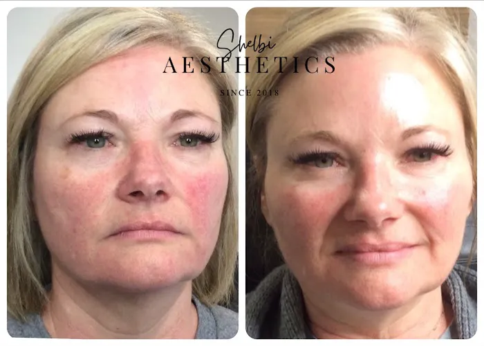 Shelbi Aesthetics and Wellness Picture 10